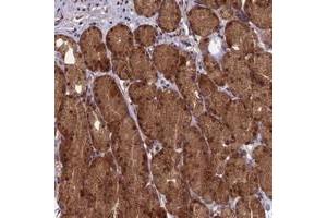 Immunohistochemical staining of human stomach with RCCD1 polyclonal antibody  shows distinct cytoplasmic and nuclear positivity in glandular cells at 1:50-1:200 dilution. (RCCD1 anticorps)