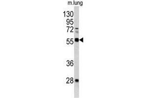 Western blot analysis of FLI1 antibody (Center) in mouse lung tissue lysates(35 µg/lane). (FLI1 anticorps  (Middle Region))