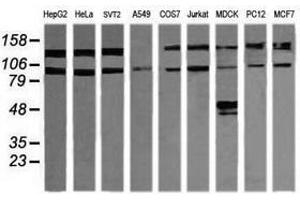 Image no. 3 for anti-Phosphoinositide-3-Kinase, Regulatory Subunit 5 (PIK3R5) antibody (ABIN1500212)