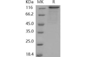 Western Blotting (WB) image for Protein Kinase D2 (PKD2) (Active) protein (GST tag,His tag) (ABIN7317066)