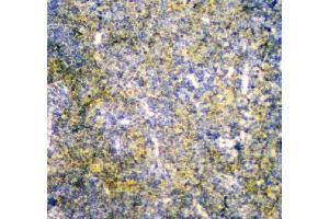 IHC analysis of MPI using anti-MPI antibody (ABIN4886672). (MPI anticorps  (AA 2-99))