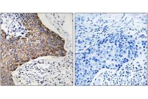 Immunohistochemistry analysis of paraffin-embedded human tonsil tissue, using C1QBP Antibody.
