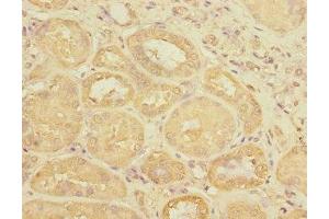 Immunohistochemistry of paraffin-embedded human kidney tissue using ABIN7175143 at dilution of 1:100 (Uroplakin 3A anticorps  (AA 19-207))