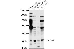 Western blot analysis of extracts of various cell lines, using SLC17A5 antibody (ABIN6294219) at 1:1000 dilution. (Solute Carrier Family 17 (Acidic Sugar Transporter), Member 5 (SLC17A5) anticorps)