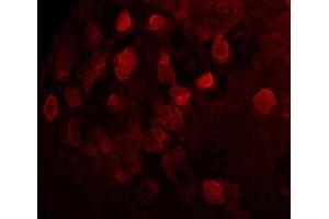 Immunofluorescence (IF) image for anti-Sarcolemma Associated Protein (SLMAP) (N-Term) antibody (ABIN7273079) (SLMAP anticorps  (N-Term))