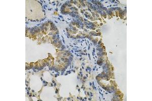 Immunohistochemistry of paraffin-embedded mouse lung using AKR1B1 Antibody. (AKR1B1 anticorps  (AA 1-316))