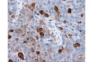 Immunohistochemical staining of paraffin-embedded Kidney tissue using anti-ANXA1 mouse monoclonal antibody. (Annexin a1 anticorps)