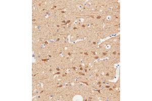 Immunohistochemical analysis of paraffin-embedded Human brain tissue using A performed on the Leica® BOND RXm. (TUBB2B anticorps  (N-Term))