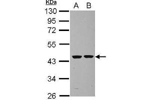 WB Image Sample (30 ug of whole cell lysate) A: U87-MG B: SK-N-SH 10% SDS PAGE antibody diluted at 1:1000 (Septin 2 anticorps)