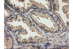 Image no. 1 for anti-Acyl-CoA Thioesterase 12 (ACOT12) antibody (ABIN1496415)