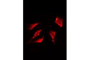 ABIN6267323 staining Hela by IF/ICC.