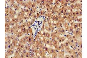 Immunohistochemistry of paraffin-embedded human liver tissue using ABIN7144062 at dilution of 1:100 (ZFAND6 anticorps  (AA 1-208))