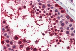 Human Testis: Formalin-Fixed, Paraffin-Embedded (FFPE)