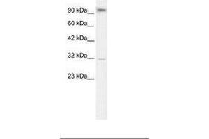 Image no. 2 for anti-Aryl Hydrocarbon Receptor (AHR) (AA 78-127) antibody (ABIN202935) (Aryl Hydrocarbon Receptor anticorps  (AA 78-127))