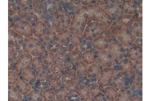 DAB staining on IHC-P; Samples: Rat Kidney Tissue