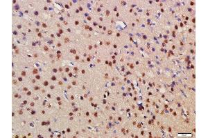 Formalin-fixed and paraffin embedded rat brain labeled with Rabbit Anti-BRD1 Polyclonal Antibody, Unconjugated (ABIN1387435) at 1:200 followed by conjugation to the secondary antibody and DAB staining (BRD1 anticorps  (AA 701-800))
