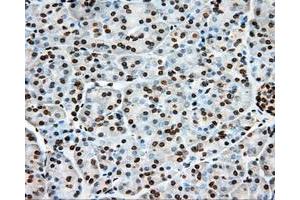 Immunohistochemical staining of paraffin-embedded liver tissue using anti-ERCC1 mouse monoclonal antibody. (ERCC1 anticorps)