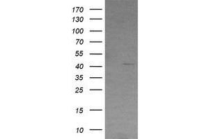 Image no. 1 for anti-Radical S-Adenosyl Methionine Domain Containing 2 (RSAD2) antibody (ABIN1501723)