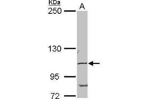 WB Image Sample (50 ug of whole cell lysate) A: Mouse brain 5% SDS PAGE antibody diluted at 1:2000