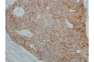 Immunohistochemistry (IHC) image for anti-Catenin, beta (CATNB) (AA 725-775) antibody (ABIN7454021)