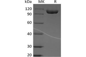 Western Blotting (WB) image for Immunoglobulin Superfamily, Member 8 (IGSF8) protein (Fc Tag) (ABIN7319850)