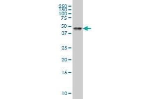 RARA monoclonal antibody (M03), clone 2D2 Western Blot analysis of RARA expression in Hela S3 NE .