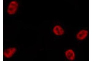 ABIN6269019 staining HepG2 by IF/ICC.