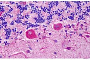 Human Cerebellum: Formalin-Fixed, Paraffin-Embedded (FFPE)