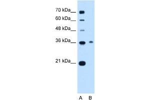 WB Suggested Anti-C11orf54 Antibody Titration:  0.
