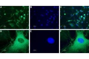 Expression of neuropeptide Y5 receptor in rat DRG - Immunocytochemical staining of a primary culture of rat dorsal root ganglion (DRG) neurons.