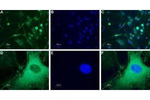 Expression of neuropeptide Y5 receptor in rat DRG - Immunocytochemical staining of a primary culture of rat dorsal root ganglion (DRG) neurons. (NPY5R anticorps  (3rd Intracellular Loop))