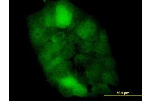 Immunofluorescence of monoclonal antibody to CSTB on A-431 cell.