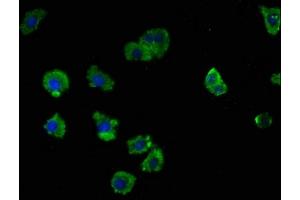 Immunofluorescence staining of HepG2 cells with ABIN7158062 at 1:100, counter-stained with DAPI. (LRTM2 anticorps  (AA 36-310))