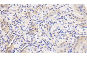 Detection of eNOS in Human Kidney Tissue using Polyclonal Antibody to Endothelial NOS (eNOS)