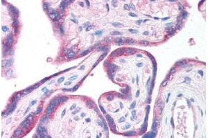 Human Placenta (formalin-fixed, paraffin-embedded) stained with CLIC6 antibody ABIN214747 at 5 ug/ml followed by biotinylated goat anti-rabbit IgG secondary antibody ABIN481713, alkaline phosphatase-streptavidin and chromogen.