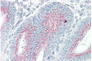 Human Uterus (formalin-fixed, paraffin-embedded) stained with ORAI3 antibody ABIN337113 at 5 ug/ml followed by biotinylated goat anti-rabbit IgG secondary antibody ABIN481713, alkaline phosphatase-streptavidin and chromogen. (ORAI3 anticorps  (N-Term))