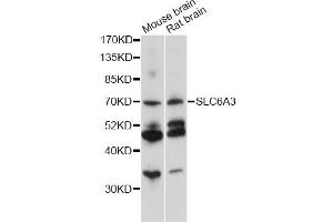 Western blot analysis of extracts of various cell lines, using SLC6A3 antibody (ABIN6291471) at 1:1000 dilution. (SLC6A3 anticorps)