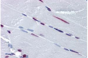 Human Skeletal Muscle: Formalin-Fixed, Paraffin-Embedded (FFPE)