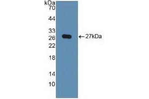 Detection of Recombinant KPNa2, Human using Polyclonal Antibody to Karyopherin Alpha 2 (KPNa2)