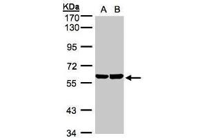 WB Image Sample(30 ug whole cell lysate) A:A431, B:Hep G2 , 7. (TBRG4 anticorps)