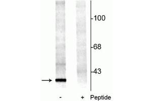 Western blot of rat brainstem lysate showing specific immunolabeling of the ~29 kDa 14-3-3 protein phosphorylated at Ser58 (-). (YWHAB anticorps  (pSer58))