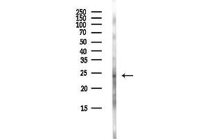 anti-Tumor Protein D52 (TPD52) antibody