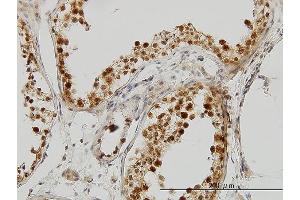 Immunoperoxidase of monoclonal antibody to PCBP2 on formalin-fixed paraffin-embedded human testis.