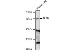 Western blot analysis of extracts of Mouse lung, using SRSF6 antibody (ABIN7270217) at 1:1000 dilution. (SFRS6 anticorps  (AA 1-100))