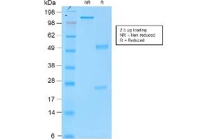 SDS-PAGE Analysis Purified Tyrosinase MouseRecombinantMonoclonal Antibody (rOCA1/812). (Recombinant TYR anticorps)