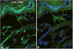 Immunofluorescence staining (green) of Human foreskin (cryo-section of unfixed tissue) with anti-Human CCM2 antibody Cat.