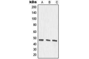 Western blot analysis of MMP27 expression in DLD (A), mouse kidney (B), rat kidney (C) whole cell lysates. (MMP27 anticorps  (Center))