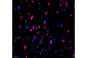 Immunofluorescence of paraffin embedded rat heart using USP24 (ABIN7076111) at dilution of 1:650 (400x lens)