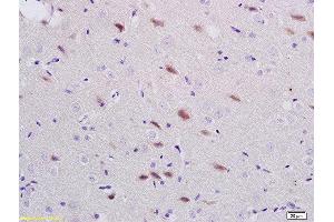 Formalin-fixed and paraffin embedded rat brain labeled with Anti-ADORA1 Polyclonal Antibody, Unconjugated  at 1:200 followed by conjugation to the secondary antibody and DAB staining (ADORA1 anticorps  (AA 225-326))