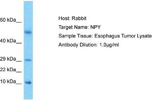 Host: Rabbit Target Name: NPY Sample Type: Esophagus Tumor lysates Antibody Dilution: 1. (NPY anticorps  (Middle Region))